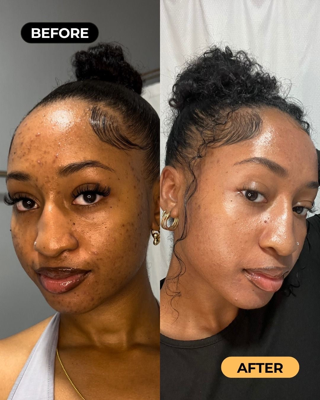 “Turmeric Golden Glow Skincare Set – Soap & Foaming Cleanser for Clear, Radiant Skin”