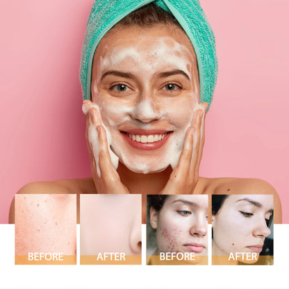 “Turmeric Golden Glow Skincare Set – Soap & Foaming Cleanser for Clear, Radiant Skin”